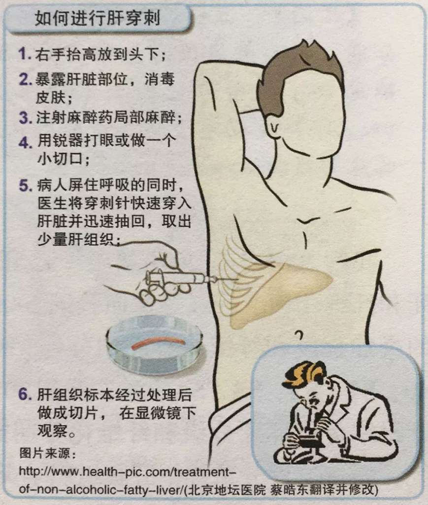 https://mmbiz.qpic.cn/mmbiz_jpg/K261SaWJtXfcgQKiaiaux2safKLkPObqbX1JqTYvTH2gZA0KmYvez3HDeyLkPPL7FeKsYxmPjk0zy415HuZzDF6w/640?wx_fmt=jpeg